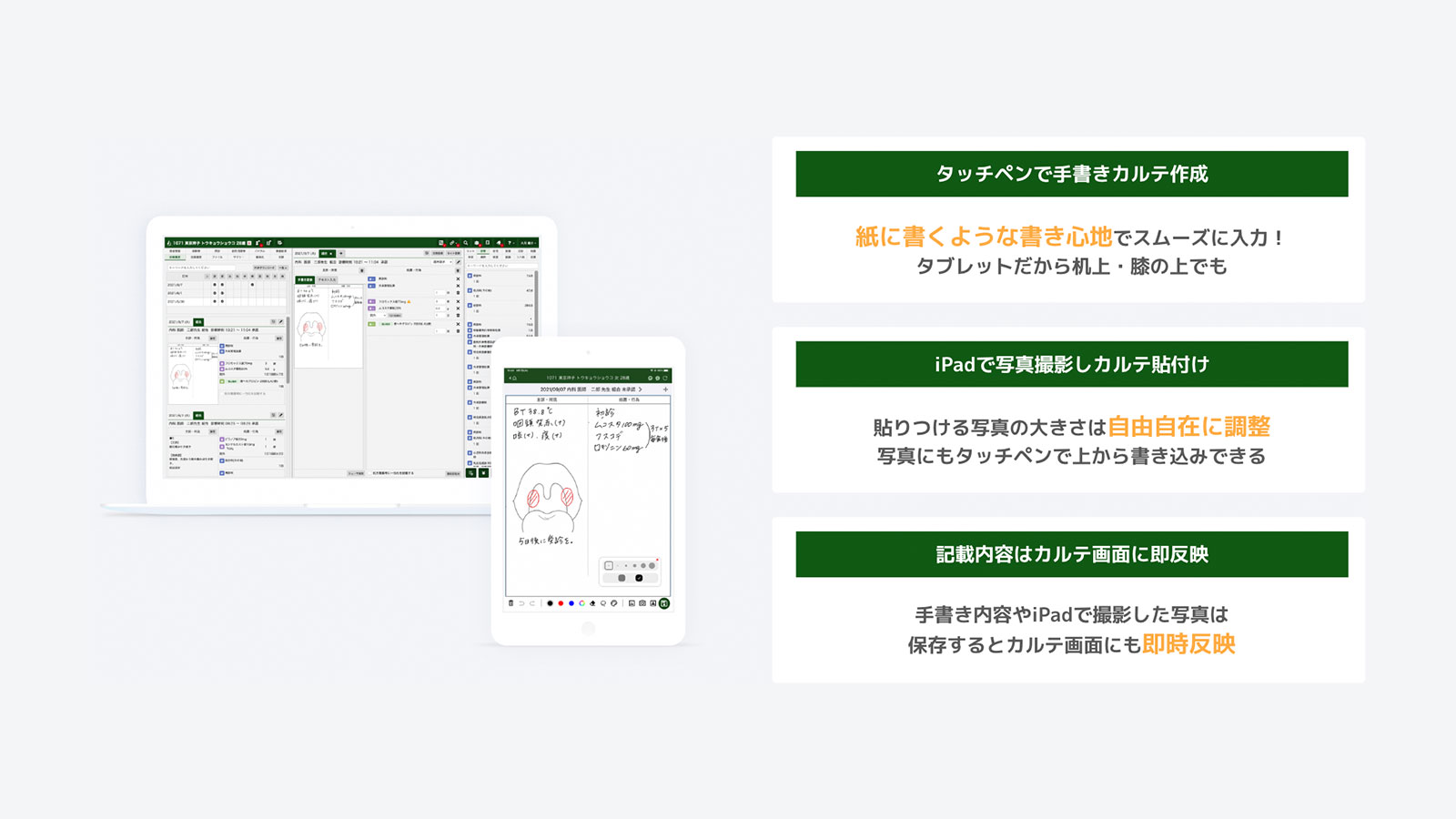 iPadアプリで手書きカルテ・写真を電子カルテに反映